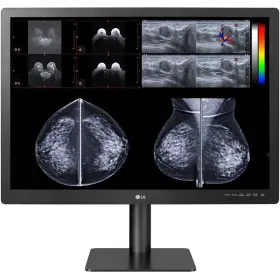 31HN713D-B LG Mammography Medical Diagnostic Pathology Monito