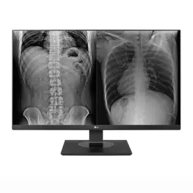 27HJ713CB LG ELECTRONICS Uhd Ips Dicom Clinical Monitor