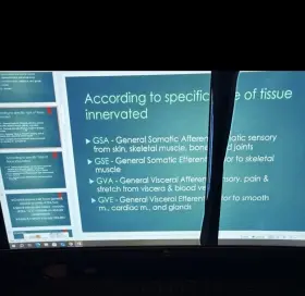 UG30201100964 Z-EDGE Curved Gaming Monitor Repair