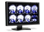 Nec Md242c2 24" Lcd Monitor Clinical Display With Front Sensor Multisync New. Fixed Price $549.99.