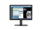 Barco Eonis Mdrc-2424 Hnib 24 Inches Color Clinical Lcd Monitor - K9610956b. Fixed Price $1183.52.