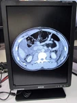 Nib! Barco Eonis Mdrc-2221 21" 2mp 21.3" Clinical Display Monitor 1600x1200. Fixed Price $299.99.