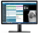 Barco Eonis Mdrc-2222 Bl 22" 2mp Color Clinical Review Display (k9307944) New. Fixed Price $750.00.