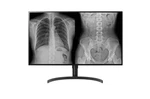 Lg 32hl512d-b 31.5" 8mp Color Diagnostic 16:9 4k Hdr Ips Monitor. Fixed Price $4900.00.