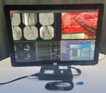 Barco Coronis Fusion Mdcc-6330 6mp 30" Color Gen. Radiology Display (k9602743). Fixed Price $1995.00.