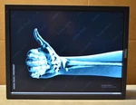 Totoku/jvc Ccl356i2 21.3" Monitor Radiology 2048x1536 Qxga Dvi Dport No Stand. Fixed Price $169.99.