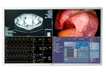 Barco Surgical Monitor, 55'', 4k Uhd. Fixed Price $4000.00.