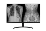 Lg 32hl512d-b 8 Mp Nano Ips Color Diagnostic Medical Monitor New/open Box. Fixed Price $2180.65.