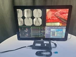 Barco Coronis Fusion Mdcc 6330 6mp 30" Color General Radiology Monitor Display. Fixed Price $3995.00.